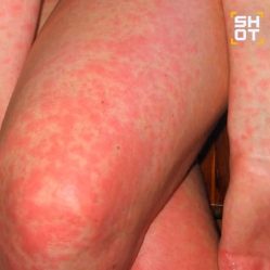 post-22766 thumbnail